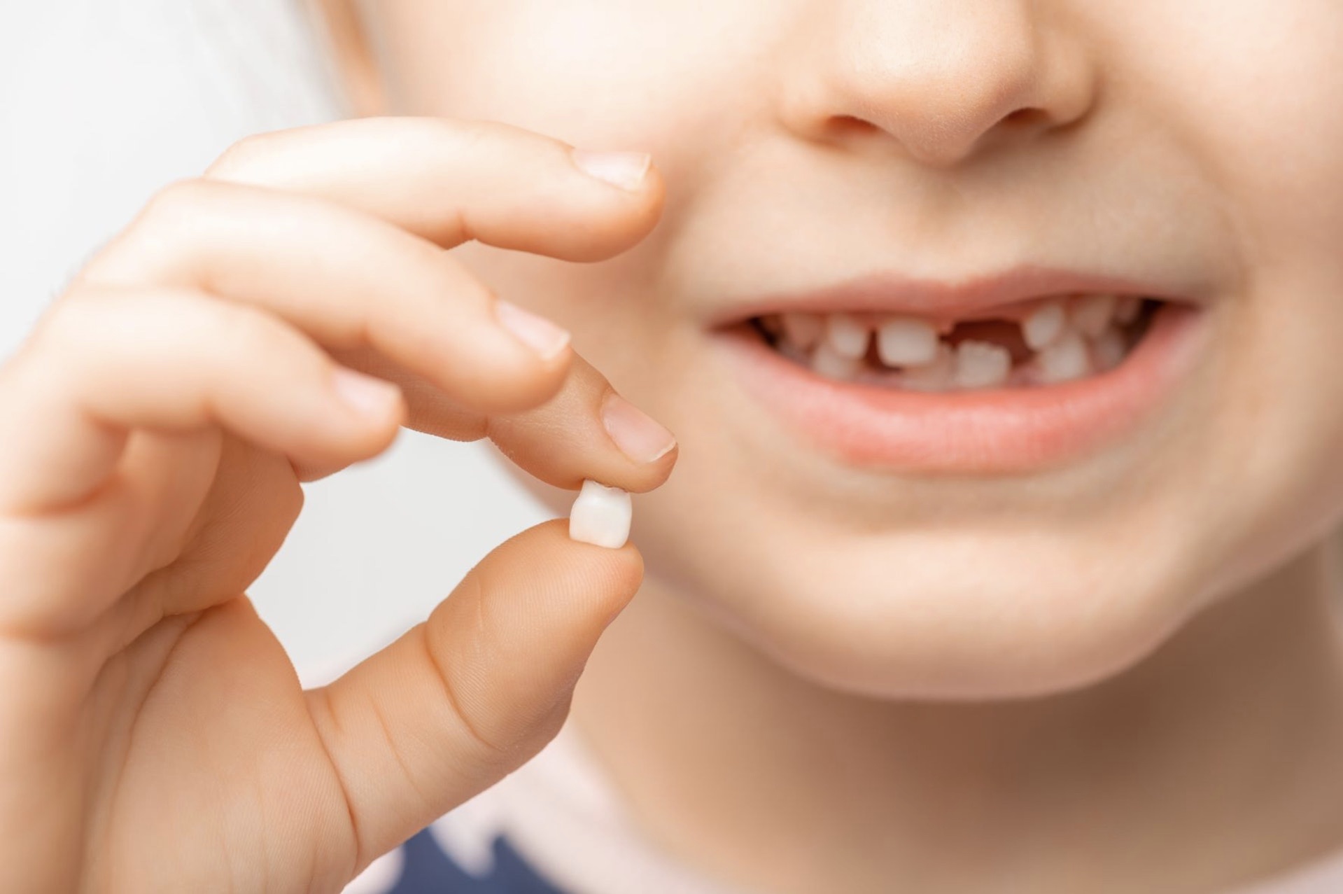 Dental Trauma