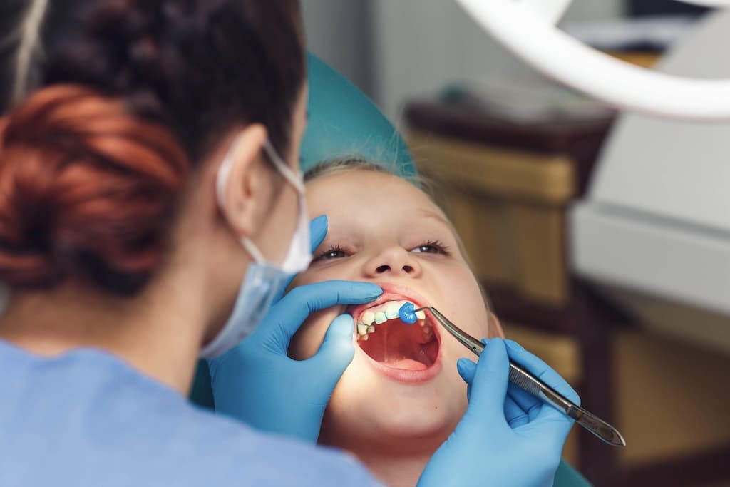 Fluoride application