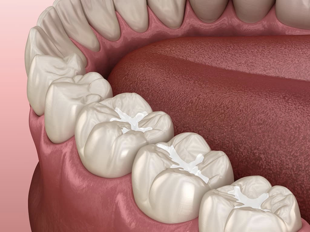 Teeth